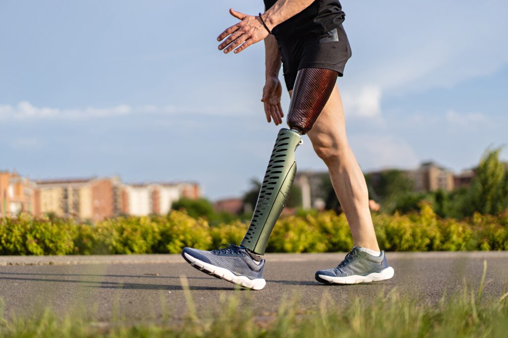 Low angle view at disabled young man with prosthetic leg walking along the a path in the park